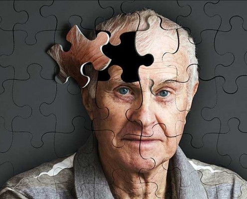 علائم آلزایمر در سالمندان