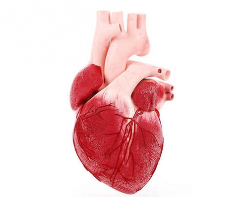 عوامل بروز سکته قلبی