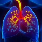 علائم و درمان آسم